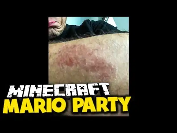 Ich bin mit einer FRAU zusammengeprallt (auf dem Fahrrad)  ✪ Minecraft Mario Party